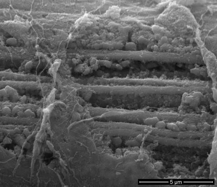 SEM - Skeletal Muscle