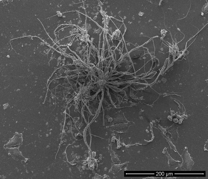 SEM - Chemically Induced Transformation of HeLa Cells