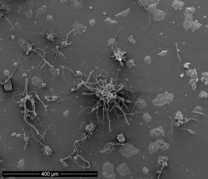 SEM - Chemically Induced Transformation of HeLa Cells