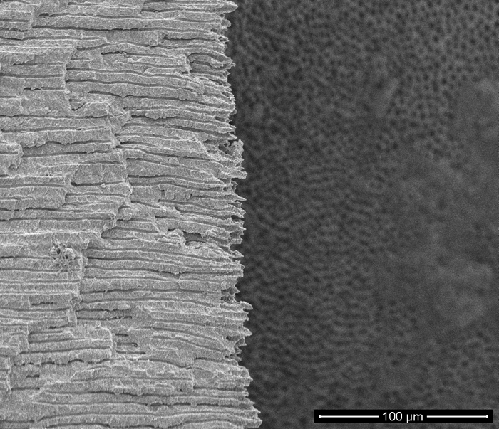 SEM - Tooth - Apical Dentin Tubule Longitudinal Section