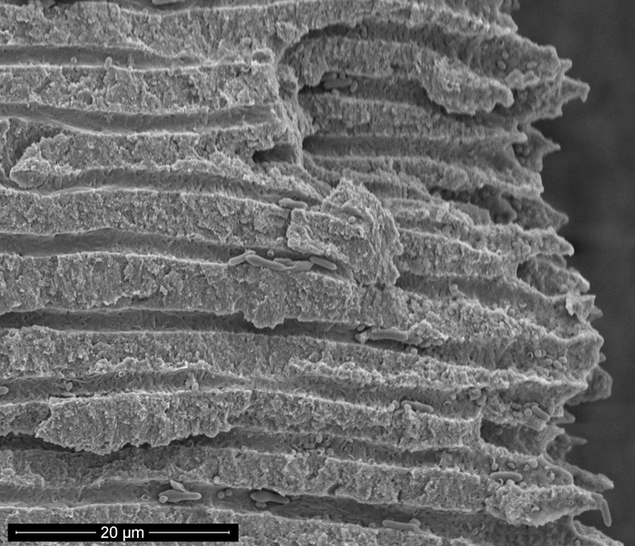 SEM - Tooth - Bacterial Invasion of Apical Dentin Tubules