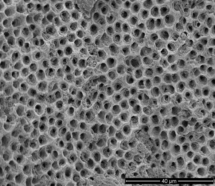 SEM - Tooth - Medial Dentin Tubule