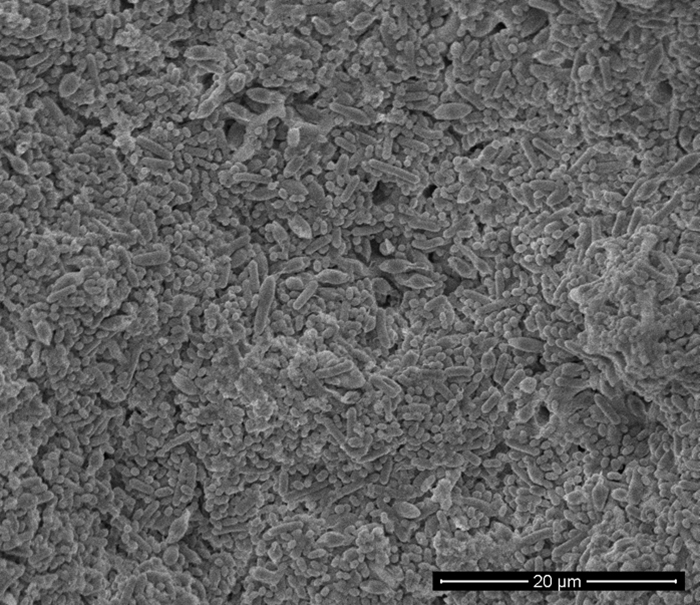 SEM - Multiple bacterial species