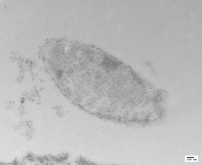IEM - Phage Infected Bacteria, labeled with 5nm gold