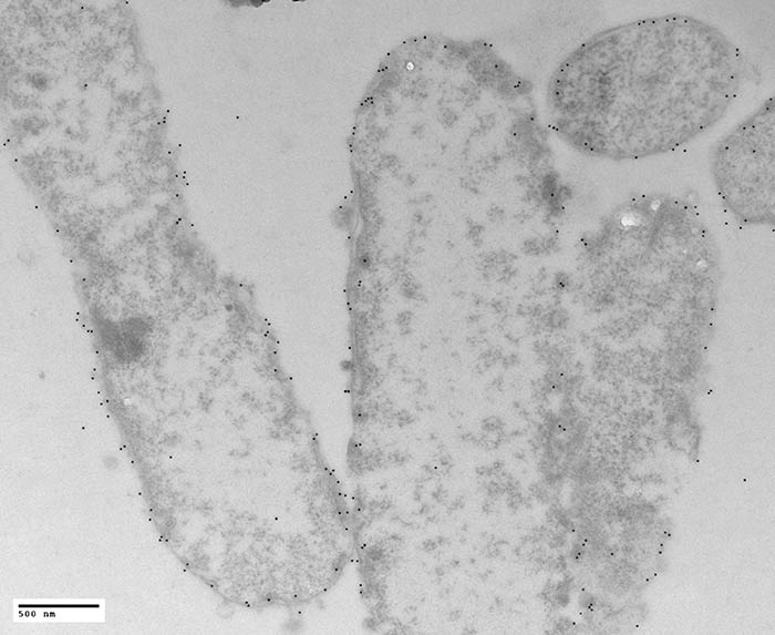 IEM - Phage infected Bacteria, labeled with 10nm gold