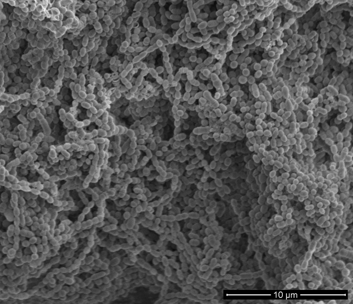 SEM - Bacterial Chains