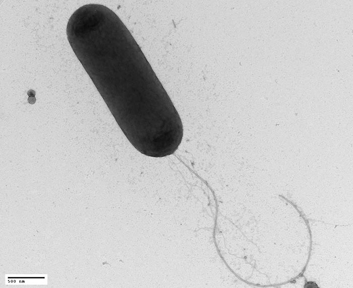 TEM - P. aeruginosa Negative Staining