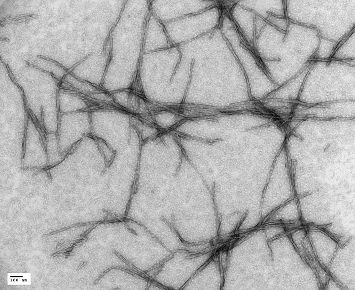 TEM - Fibril Formation