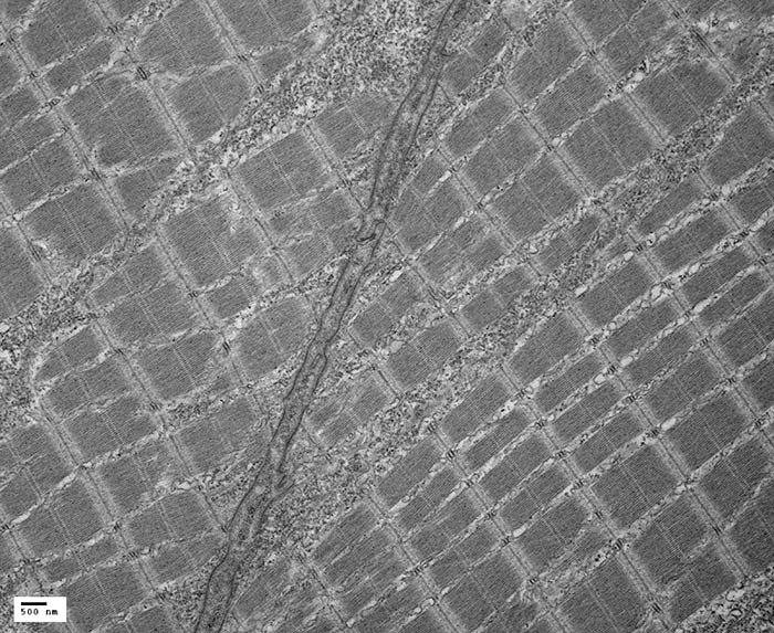 TEM - Zebrafish Muscle Fibers