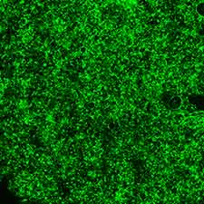 Lentivirus Transduction in HEK Cells