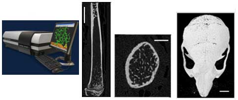 Microcomputed Tomography