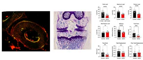 Static and Dynamic Histomorphometry