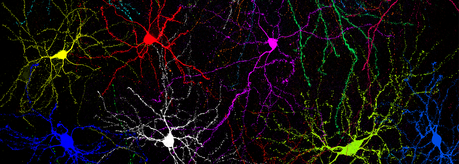 Brightly colored neurons filled with fluorescent dyes