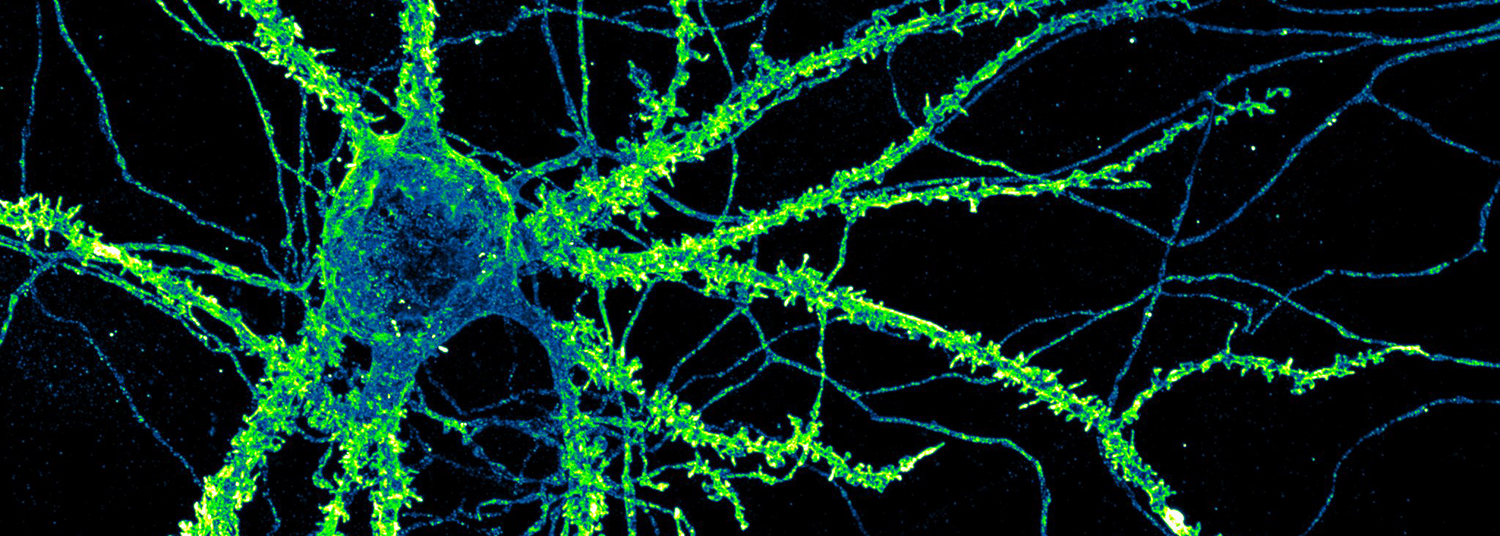 Blood vessels in the brain labeled with colorful dyes
