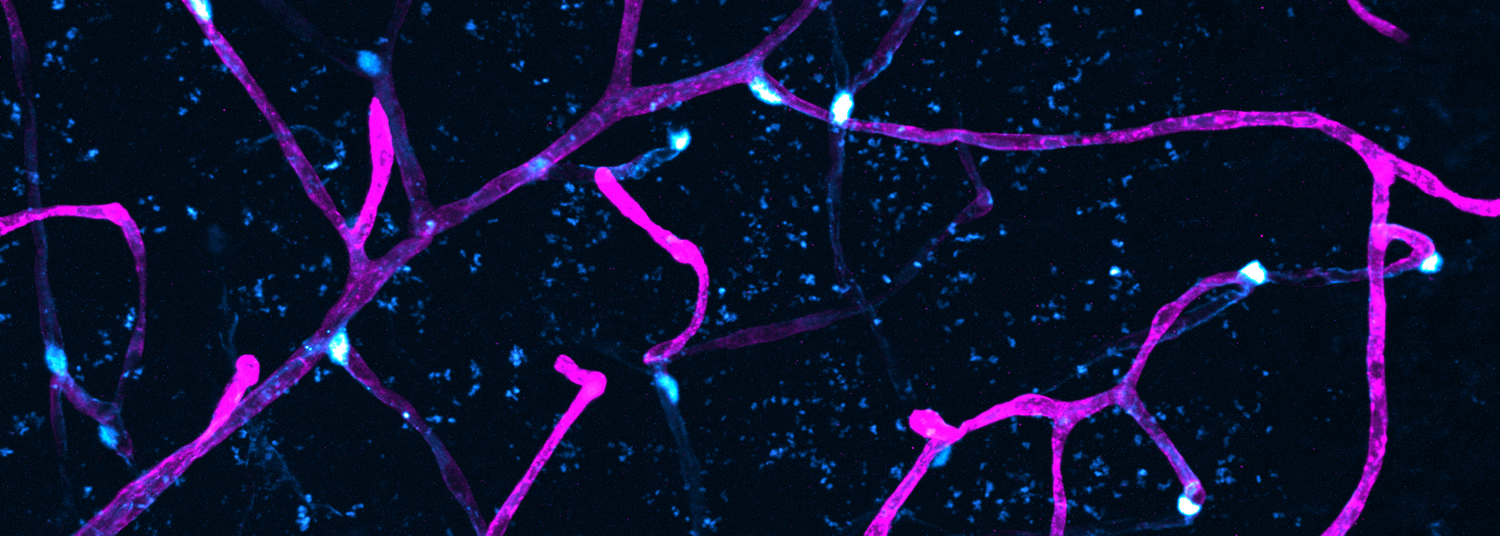 Brightly colored blood vessels and cells in the brain