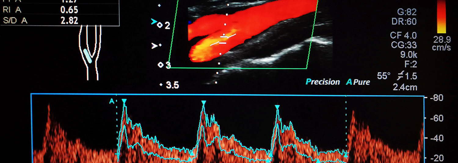 Vascular Imaging Banner04