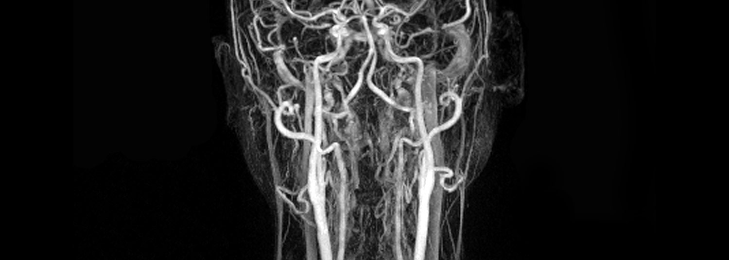 Vascular Imaging Banner05