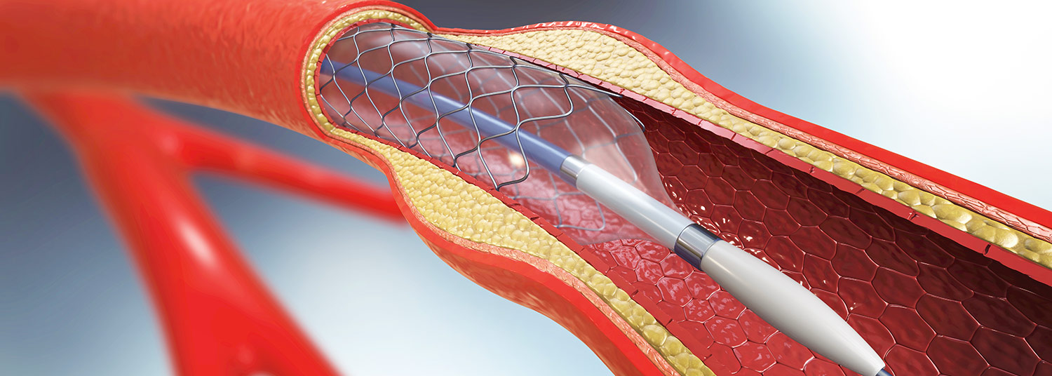 Vascular Research Banner03