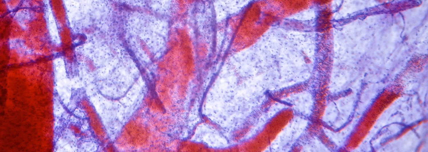 Vascular Research Banner04